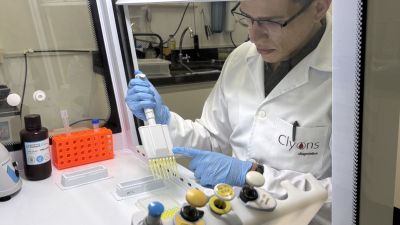 UFSCar licencia tecnologia para diagnóstico sorológico da hanseníase