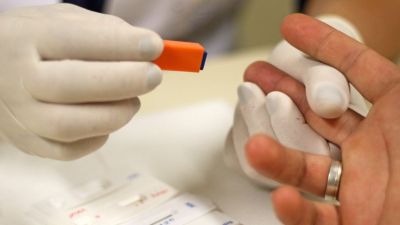 Secretaria de saúde realiza simpósio HIV - fique sabendo nesta sexta-feira