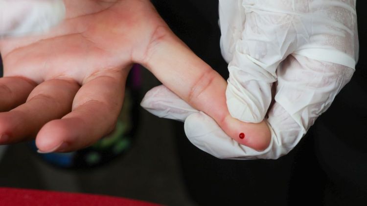 Brasil atinge meta de redução da transmissão vertical de hepatite B