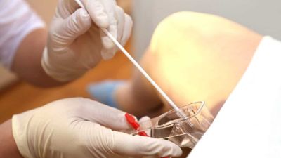 Saúde intensifica coleta do exame de papanicolau durante campanha Março Lilás