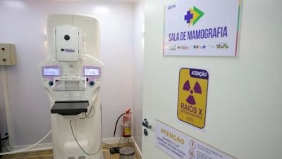 Homens costumam descobrir câncer de mama em estágio mais avançado
