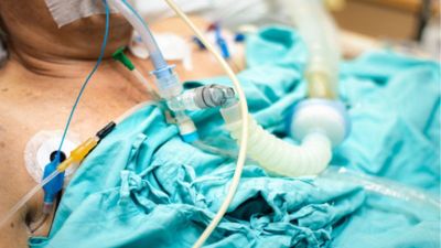 Procedimentos médicos – incluindo intubações – mais seguros com aplicação de luz e curcumina contra infecções hospitalares