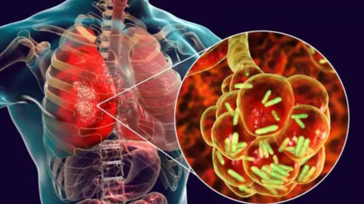 Pesquisadores unem luz e antibióticos em uma nova estratégia contra superbactérias hospitalares
