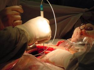 USP de São Carlos: Técnica monitora órgãos para transplante
